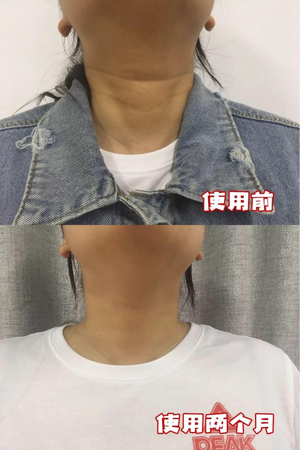 最新美容院儀器，重塑美麗的科技革新力量